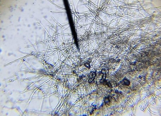 Widok pleśni pod mikroskopem